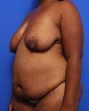 Case # 15 before photo