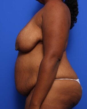 Case # 15 before photo