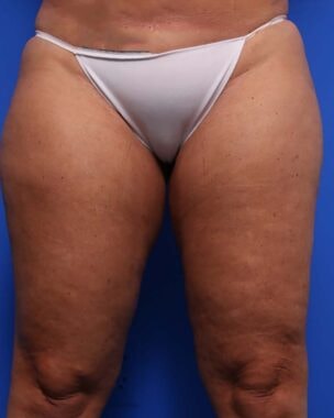 Case # 16 before photo