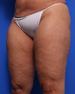 Case # 16 before photo