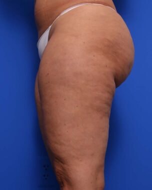 Case # 16 before photo