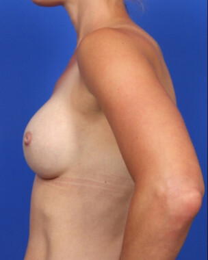 Case # 86 after photo