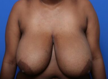 Case # 3 before photo