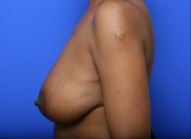 Case # 11 before photo