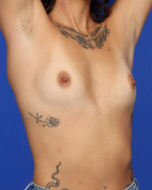 Case # 90 before photo