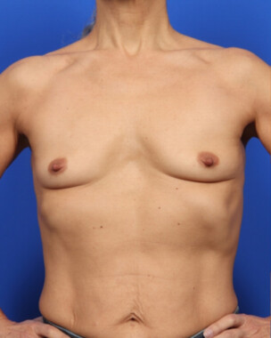 Case # 99 before photo