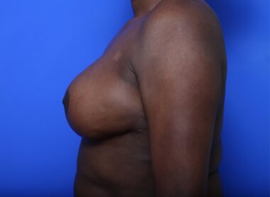 Case # 15 after photo