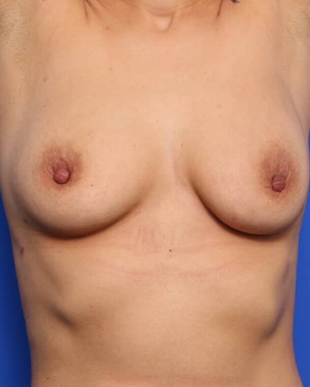 after image