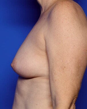 Case # 13 before photo