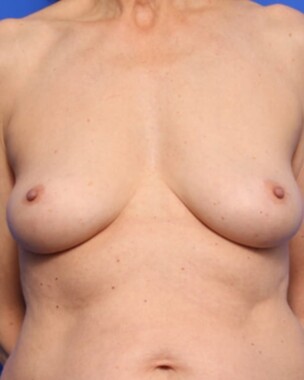 Case # 14 before photo