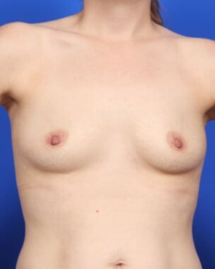 Case # 19 before photo