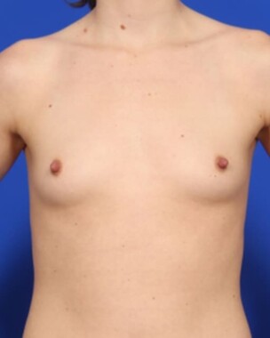 Case # 20 before photo