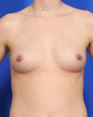 Case # 20 after photo