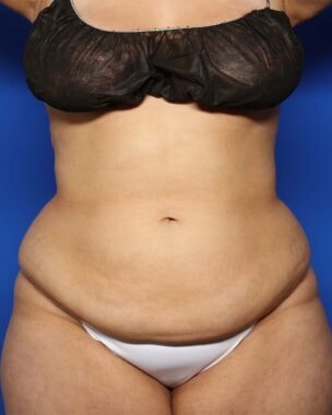 Case # 1 before photo