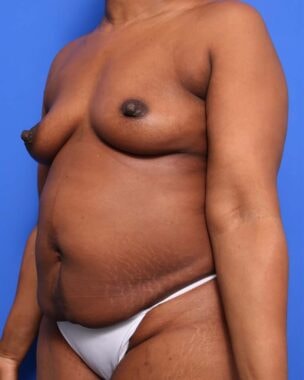 Case # 48 before photo