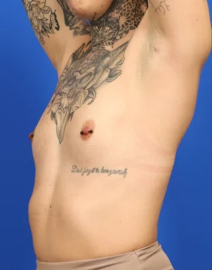 Case # 102 before photo