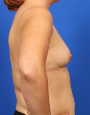 Case # 103 before photo