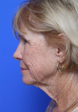 Case # 20 before photo