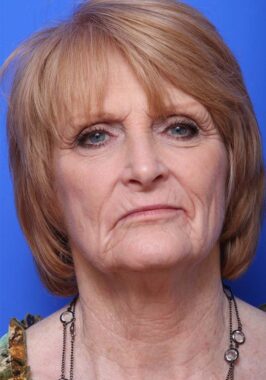 Case # 22 before photo