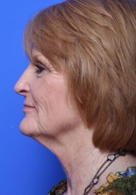 Case # 22 before photo