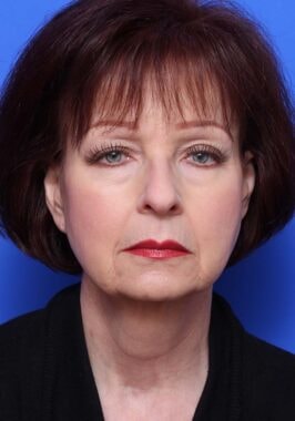 Case # 24 before photo