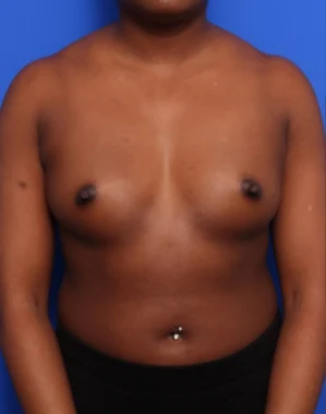 Case # 114 before photo