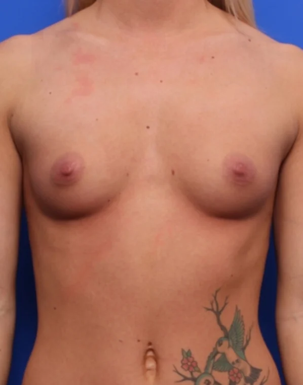 before image