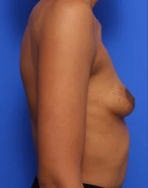 Case # 121 before photo