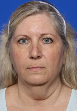 Case # 27 before photo