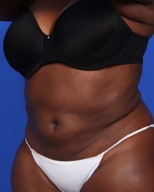 Case # 23 before photo