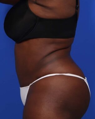 Case # 23 after photo