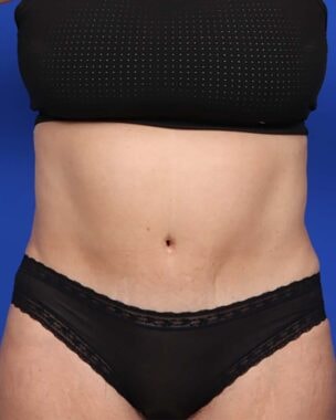 Case # 24 after photo