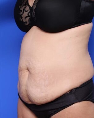 Case # 24 before photo