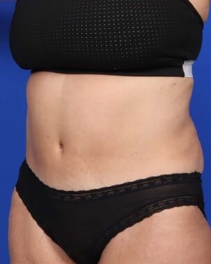 Case # 24 after photo