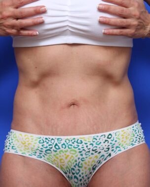 Case # 25 after photo