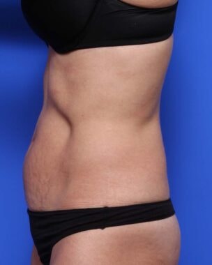 Case # 25 before photo