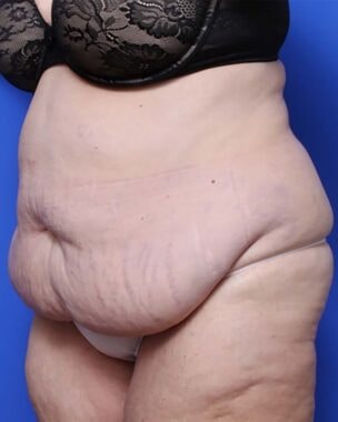 Case # 26 before photo