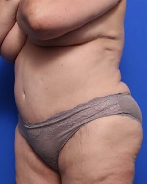 Case # 26 after photo