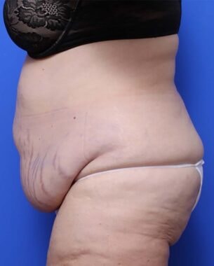 Case # 26 before photo