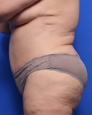 Case # 26 after photo