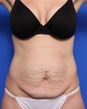 Case # 28 before photo