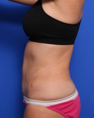 Case # 28 after photo