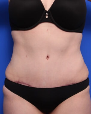 Case # 31 after photo