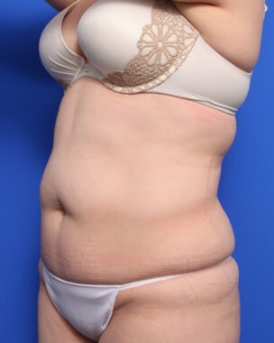 Case # 31 before photo