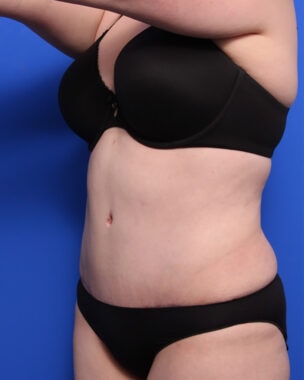 Case # 31 after photo