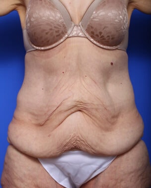 Case # 29 before photo