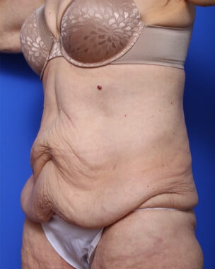 Case # 29 before photo