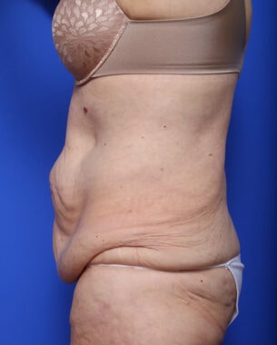 Case # 29 before photo