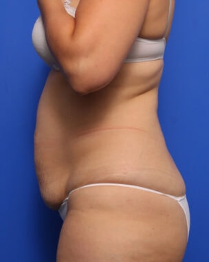 Case # 30 before photo