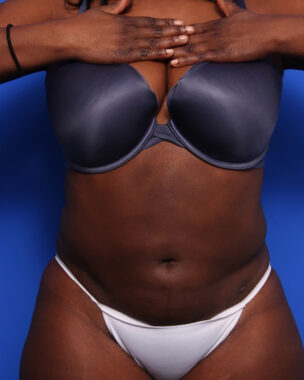 Case # 6 after photo